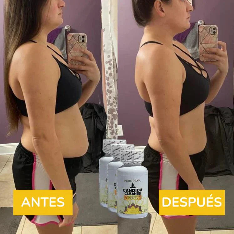 Candida Cleanse™ – Kit Natural para Cándida, Abdomen Plano y Eliminar la Lengua Blanca