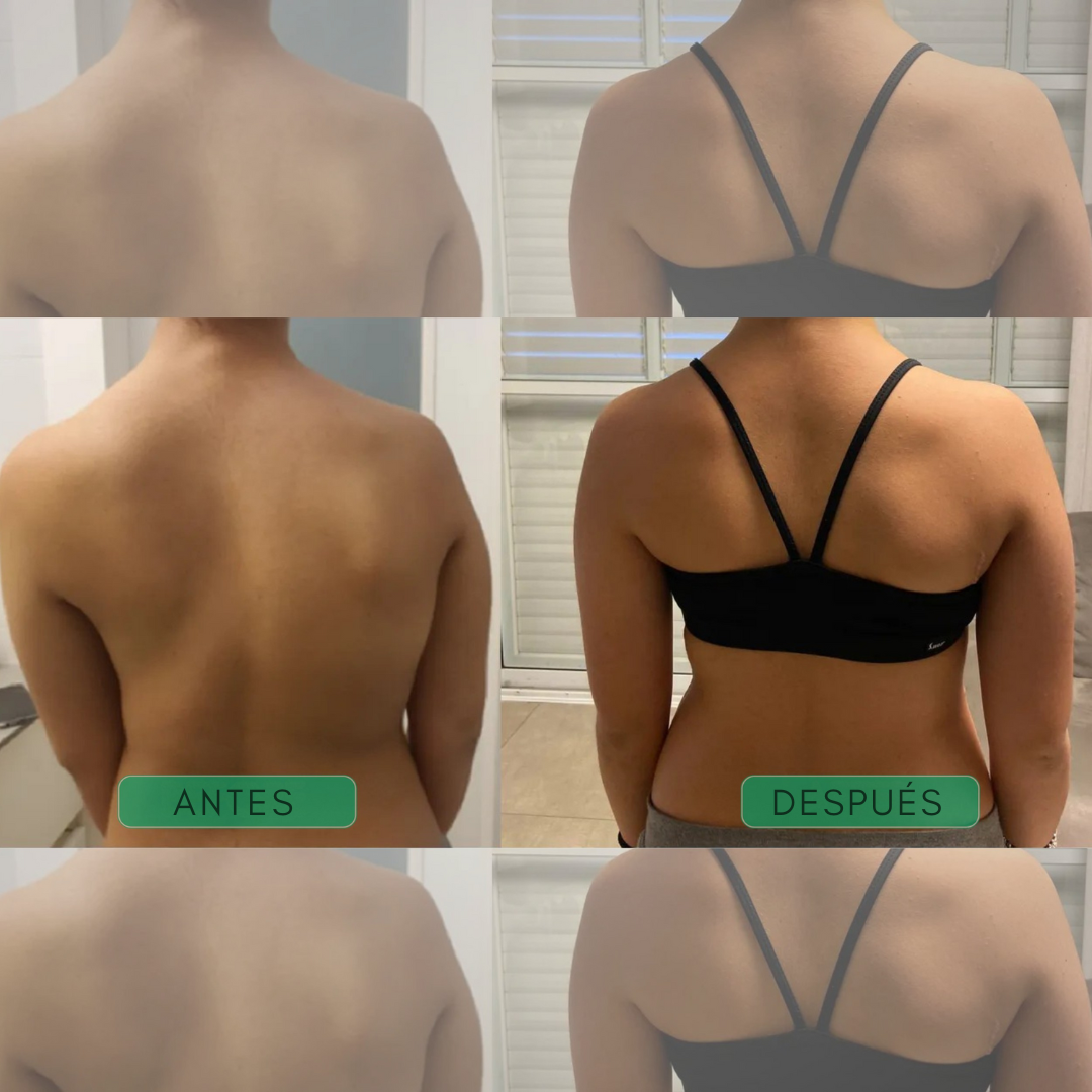 Corrector de Postura Instantáneo - Posturex